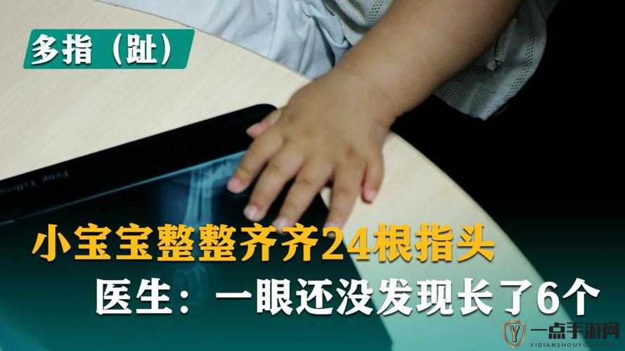 宝宝才三根手指就受不了：探究背后的原因与解决方法